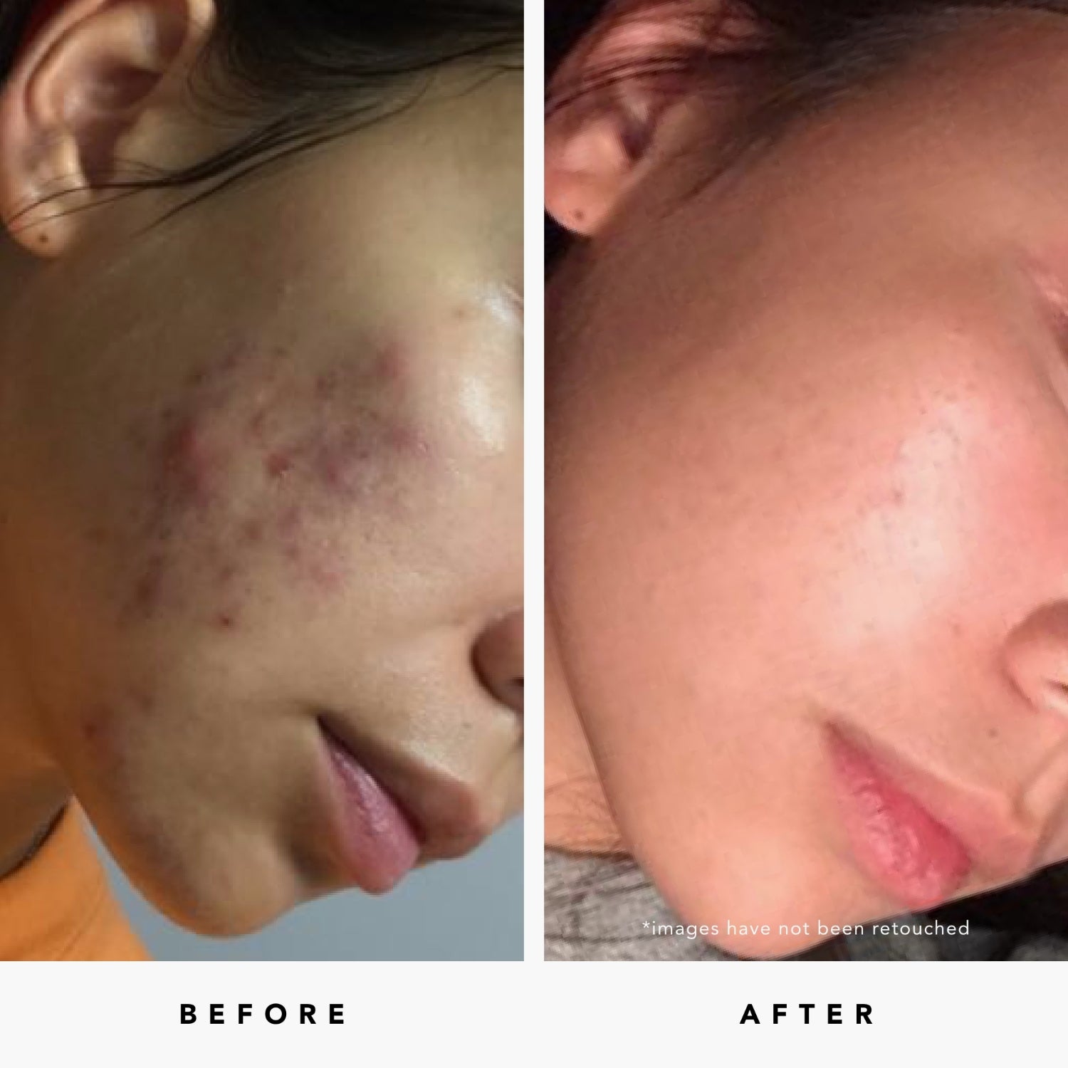 BLUE TANSY Invisible Pores Resurfacing Clarity Mask | Herbivorebotanicalss