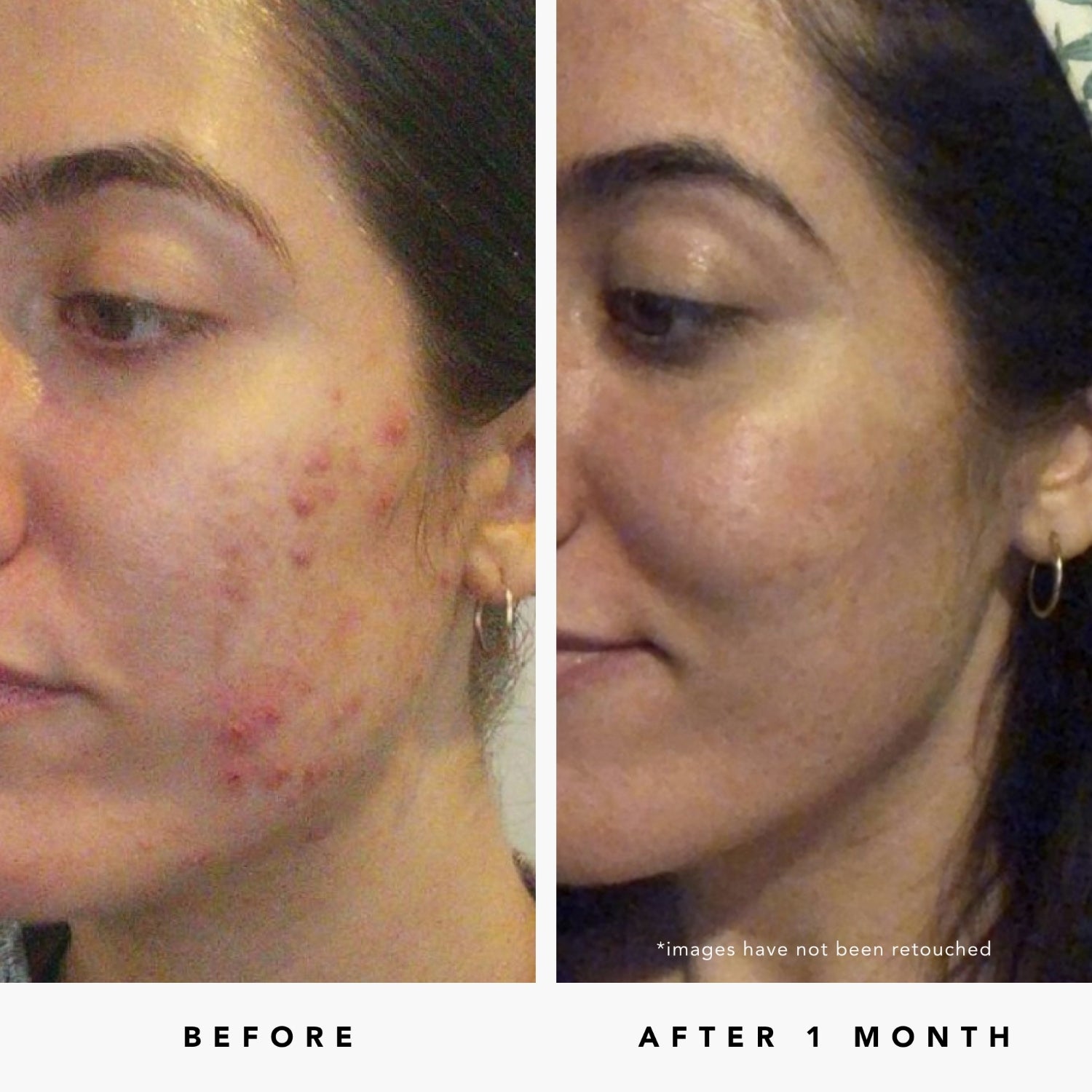 BLUE TANSY Invisible Pores Resurfacing Clarity Mask | Herbivorebotanicalss