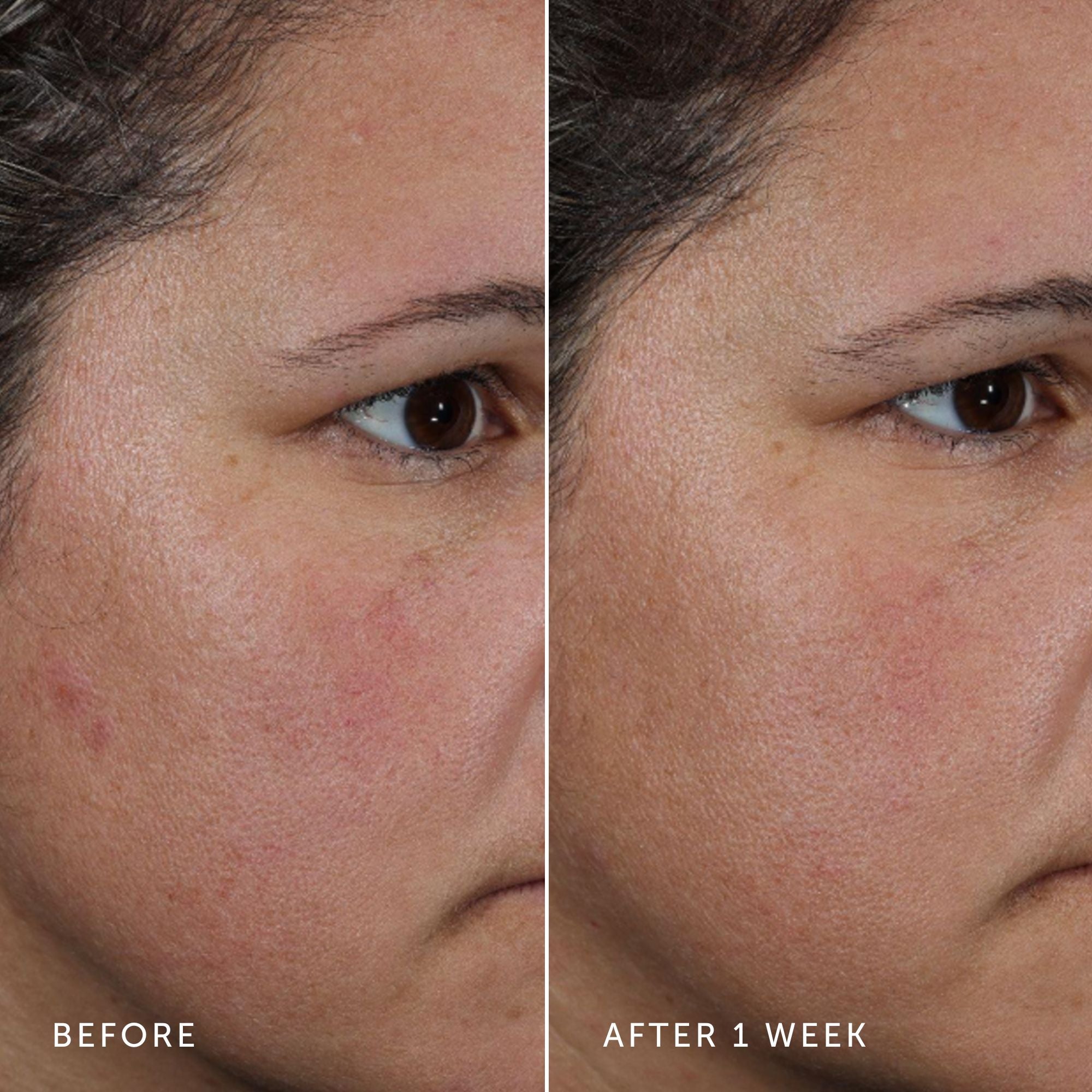 NOVA Turmeric + Niacinamide Bi-Phase Glow Facial Oil