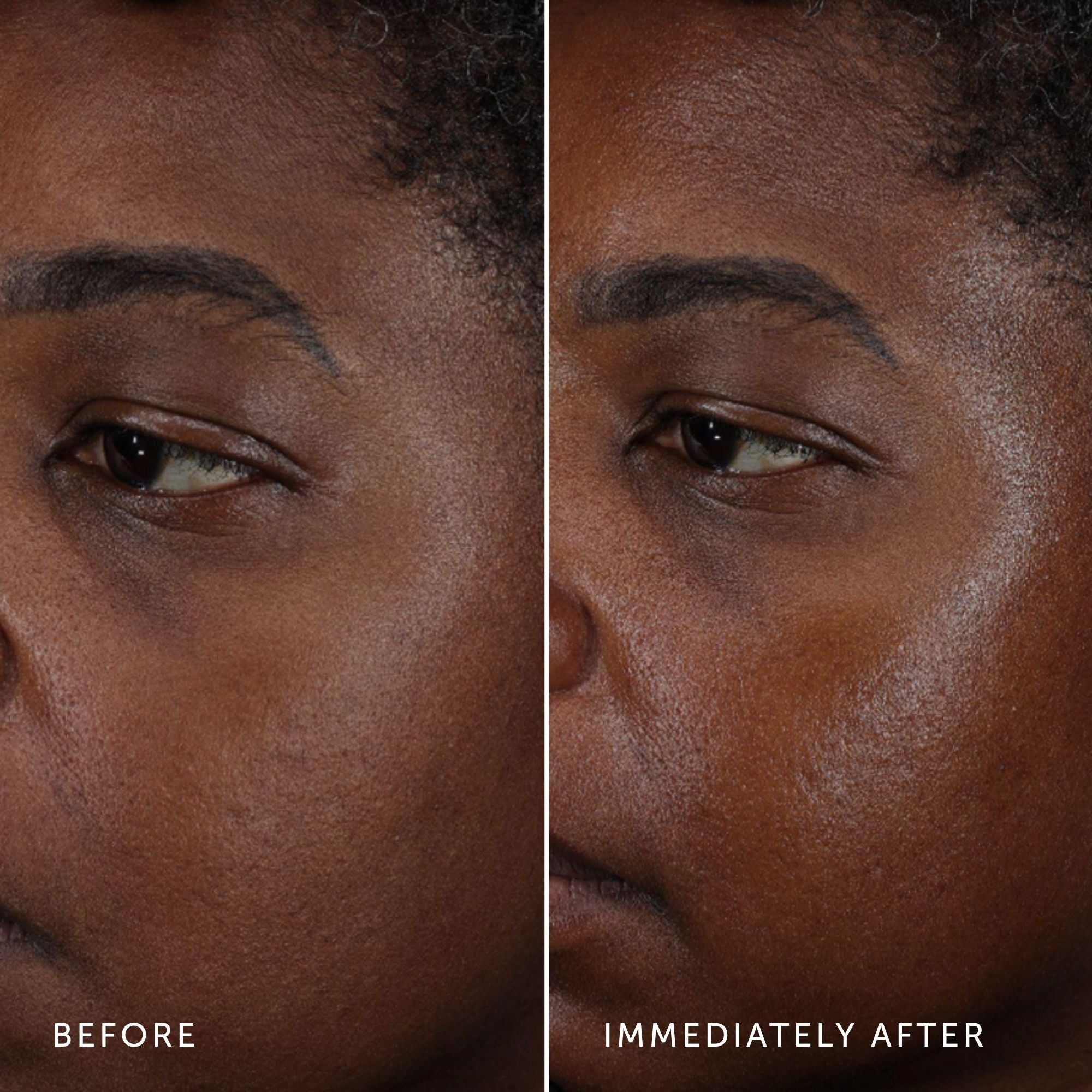NOVA Turmeric + Niacinamide Bi-Phase Glow Facial Oil