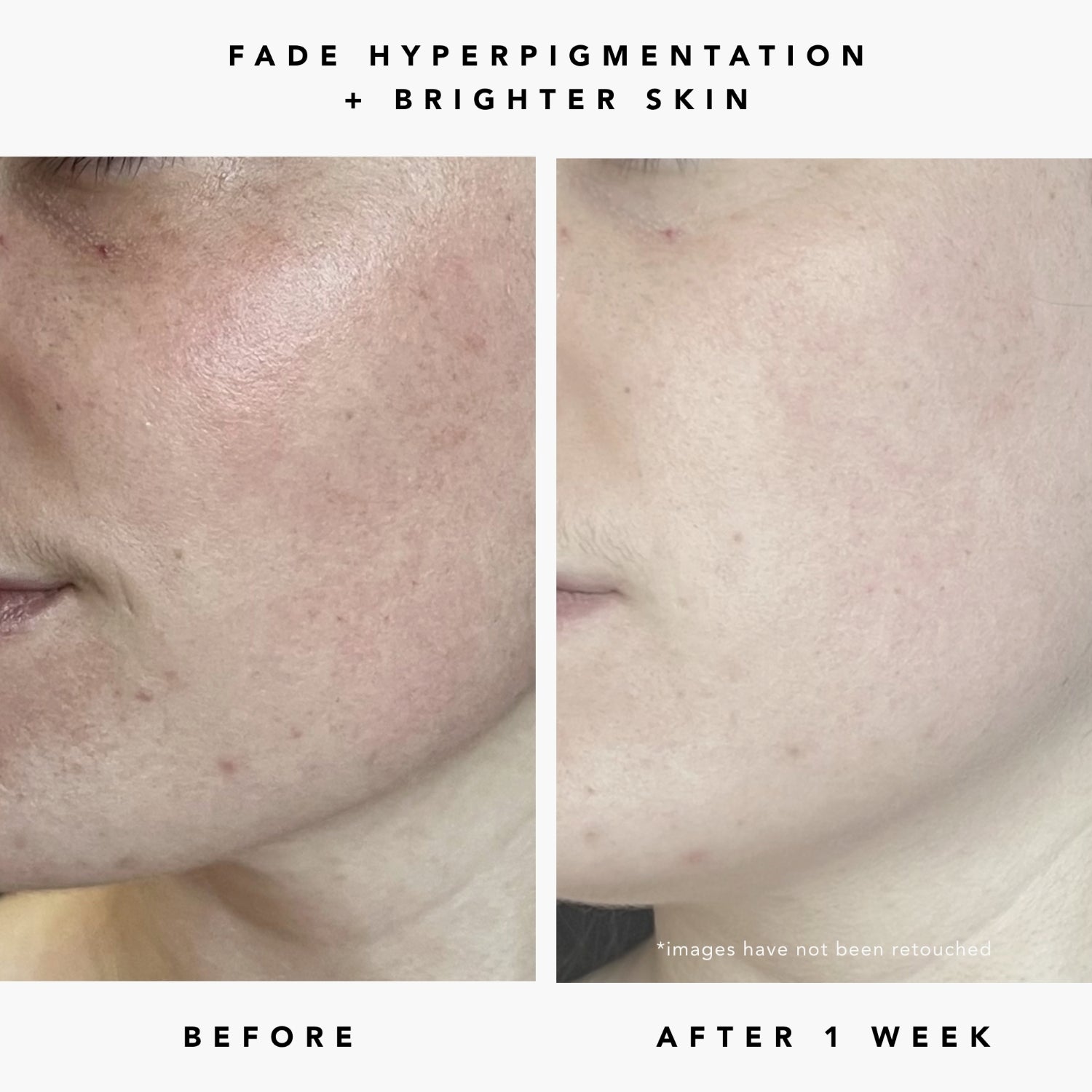 MILKY WAY 10% AHA + Oat Soothing Exfoliating Serum | Herbivorebotanicalss