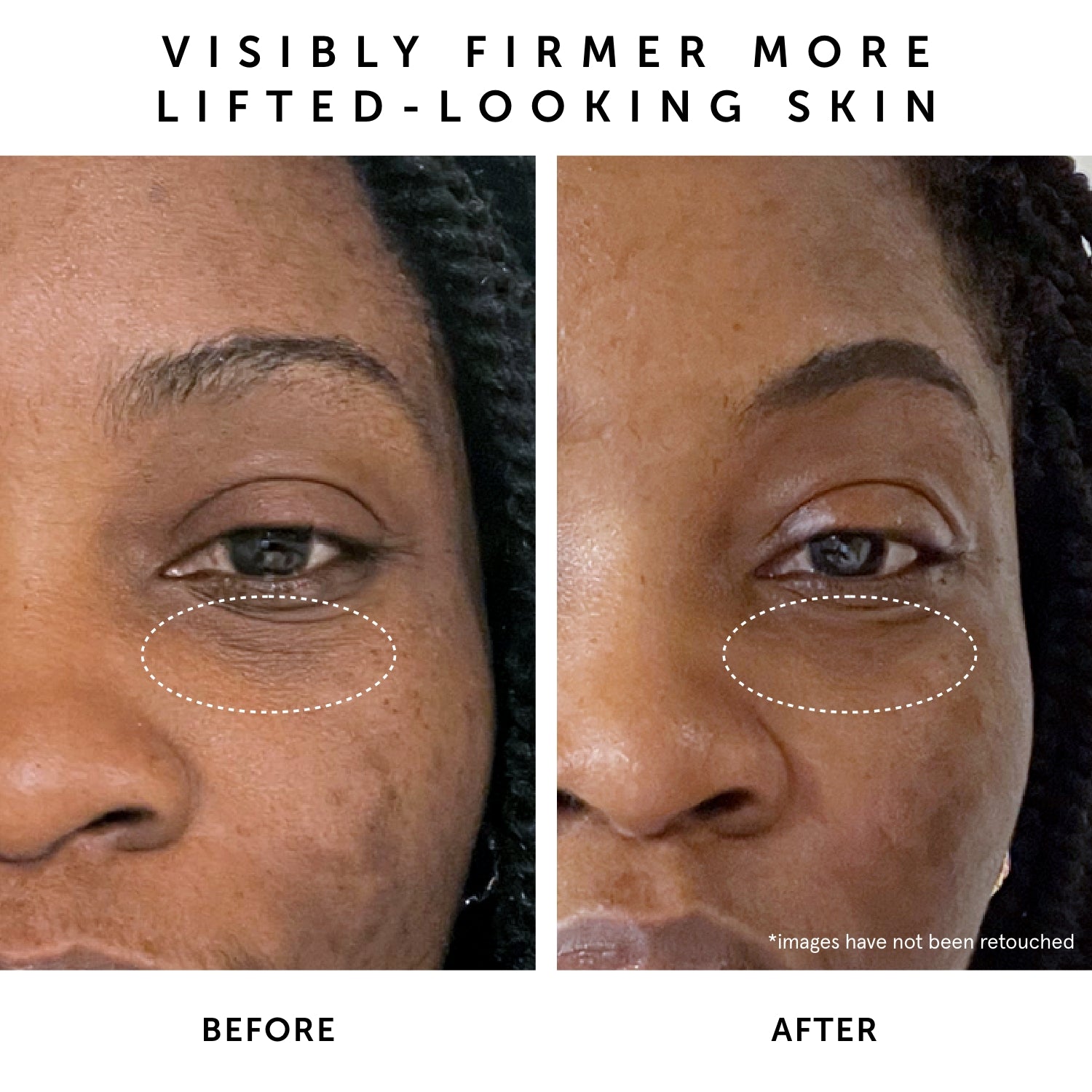 MOON FRUIT 1% Bakuchiol + Peptides Retinol Alternative Serum | Herbivorebotanicalss
