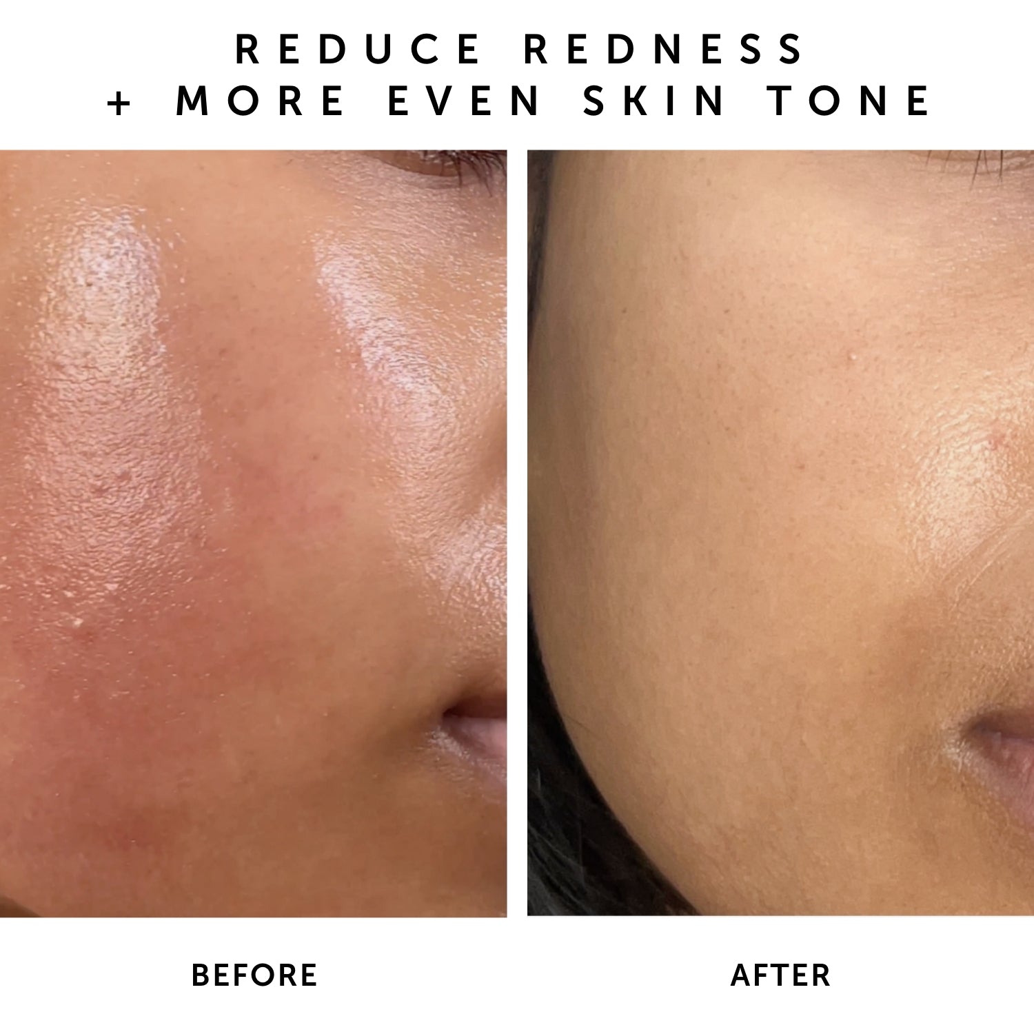 NOVA 15% Vitamin C + Turmeric Brightening Serum | Herbivorebotanicalss